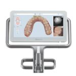 インビザライン治療における光化学式口腔内スキャナーとは