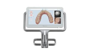 インビザライン治療における光化学式口腔内スキャナーとは